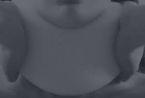 whiplash-injury-practice-areas